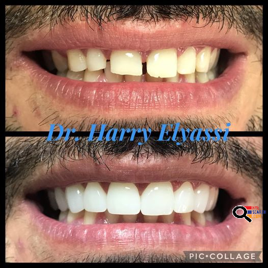 Atrium Dental - Dr. Harry H. Elyassi in Glendale, CA