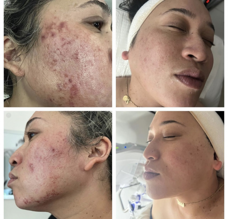Skin Care by Anna Fashionista/Esthetician Cosmetologist